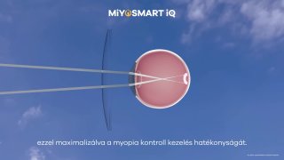 MiYOSMART iQ - SMART Zóna rövid összefoglaló