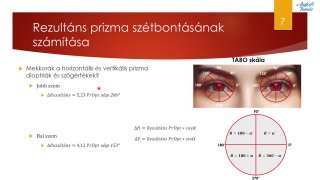 Prizmás szemüveglencse működése